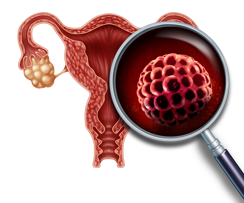 ovary zoom in human uterus 