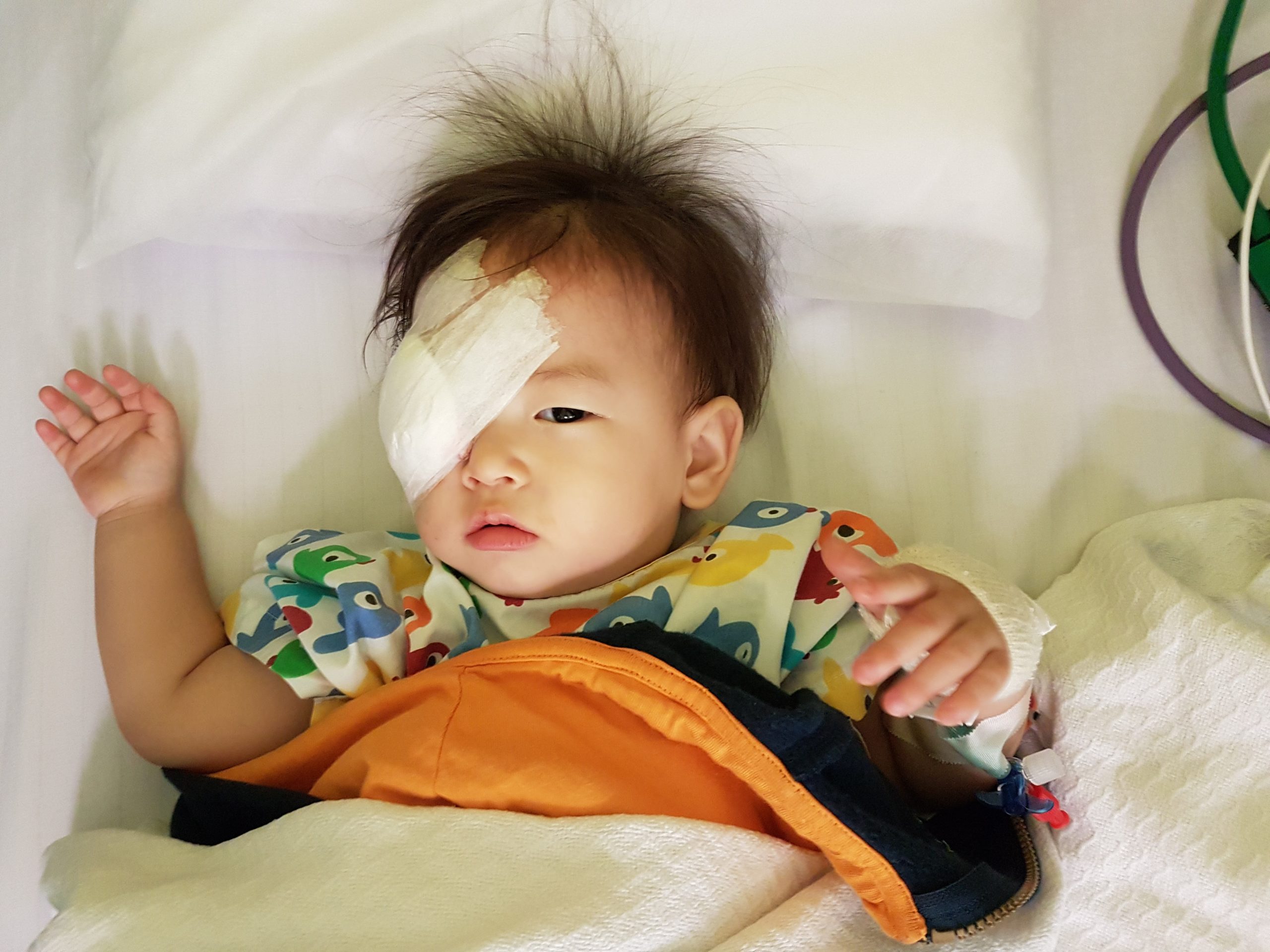 retinoblastoma in children